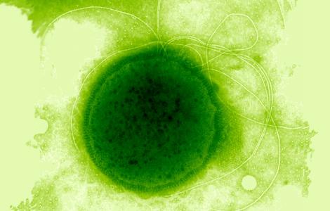 Thermococcus gammatolerans.jpg